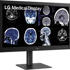 Moniteur d'affichage médical de diagnostic 8MP - 31.5