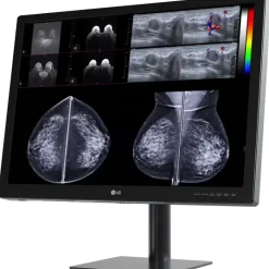 Moniteur d'affichage médical de diagnostic 8MP - 31.5
