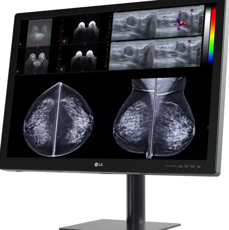 Moniteur d'affichage médical de diagnostic 8MP - 31.5" LG Electronics 32HQ713D