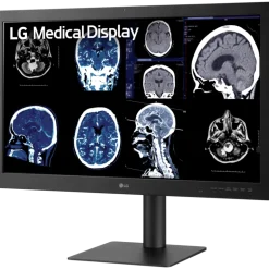 Moniteur d'affichage médical de diagnostic 8MP - 31.5