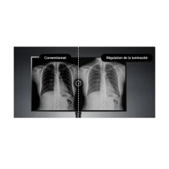 Moniteur d'affichage médical de diagnostic 8MP - 31.5