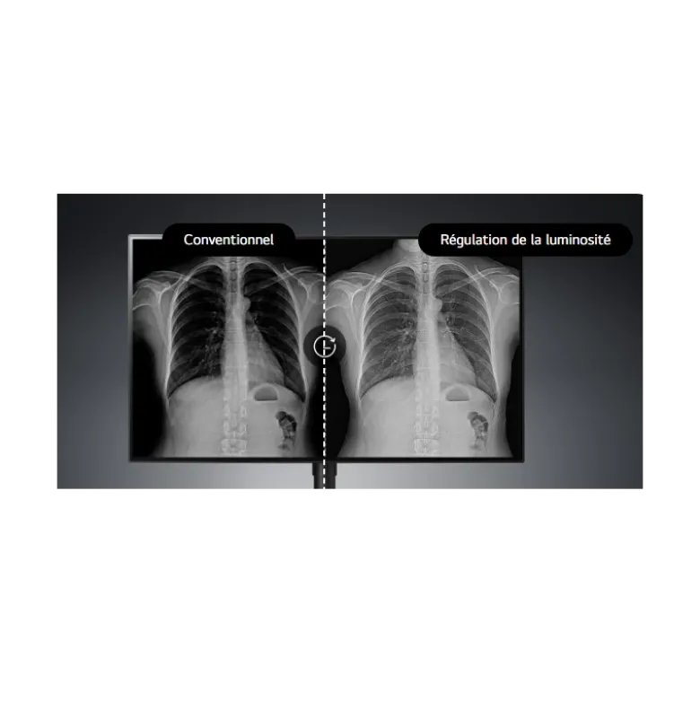 Moniteur d'affichage médical de diagnostic 8MP - 31.5" LG Electronics 32HQ713D