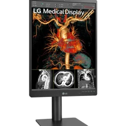 Moniteur d'affichage médical de diagnostic 3MP - 21" LG Electronics 21HQ513D