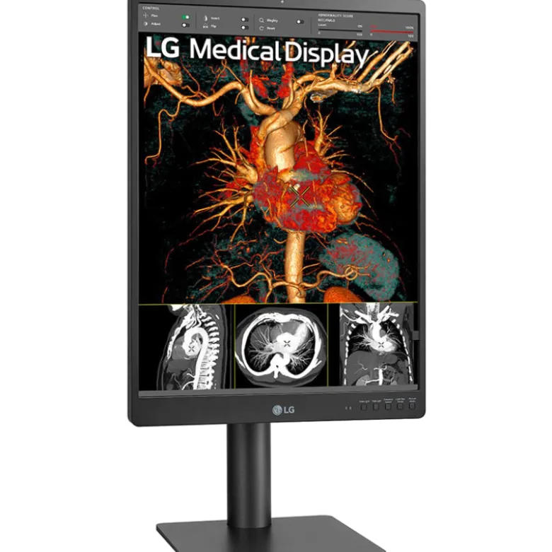 Moniteur d'affichage médical de diagnostic 3MP - 21" LG Electronics 21HQ513D