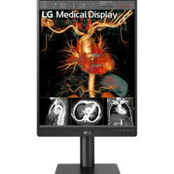Moniteur d'affichage médical de diagnostic 3MP - 21