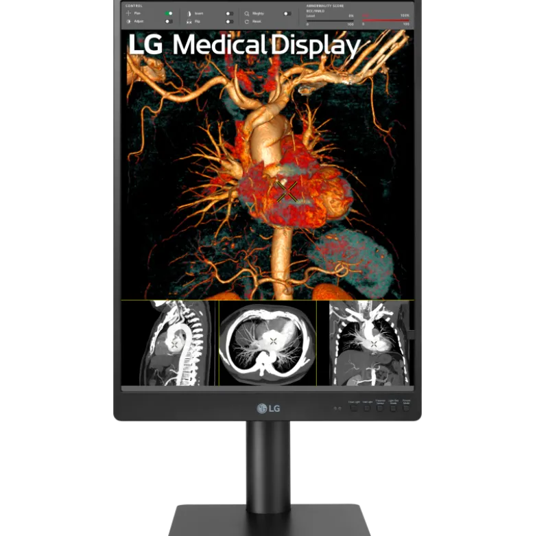 Moniteur d'affichage médical de diagnostic 3MP - 21" LG Electronics 21HQ513D