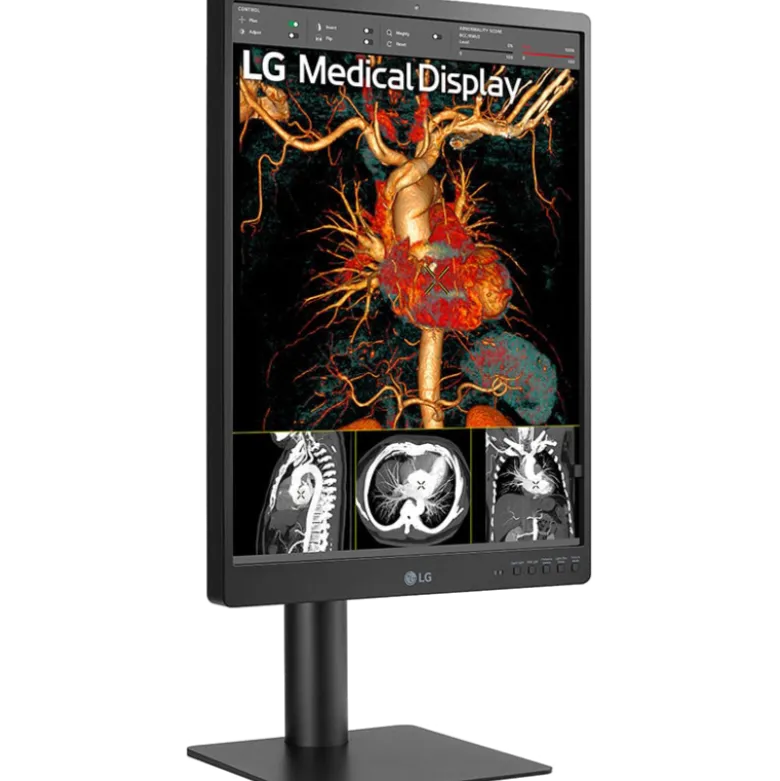 Moniteur d'affichage médical de diagnostic 3MP - 21" LG Electronics 21HQ513D