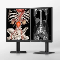 Moniteur d'affichage médical de diagnostic 3MP - 21