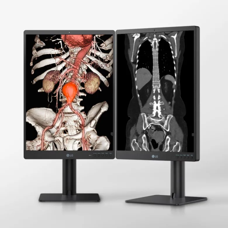 Moniteur d'affichage médical de diagnostic 3MP - 21" LG Electronics 21HQ513D