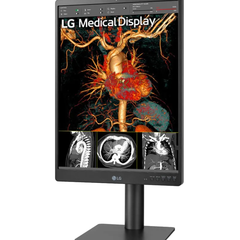 Moniteur d'affichage médical de diagnostic 3MP - 21" LG Electronics 21HQ513D