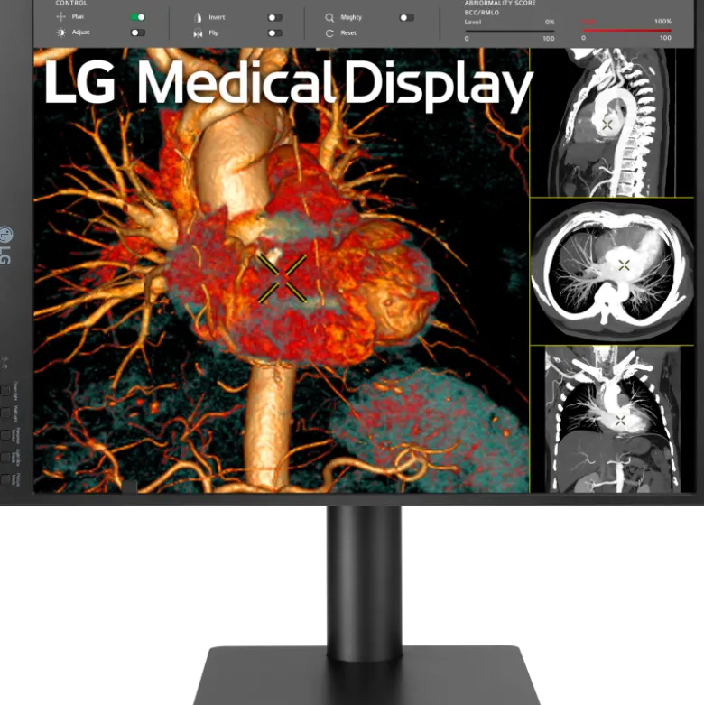 Moniteur d'affichage médical de diagnostic 3MP - 21" LG Electronics 21HQ513D