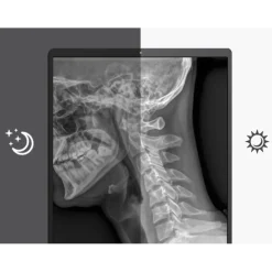 Moniteur d'affichage médical de diagnostic 3MP - 21