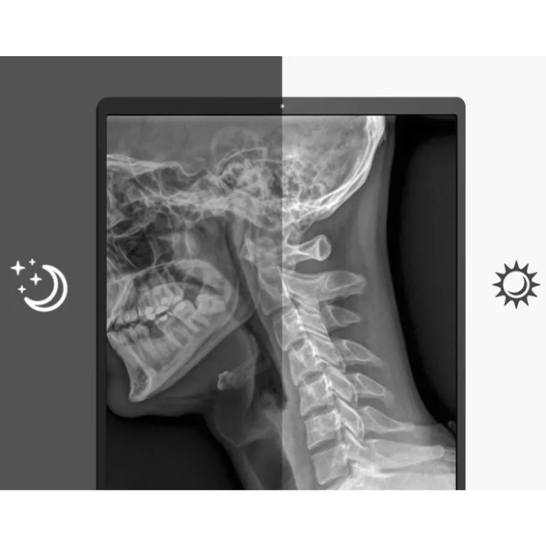 Moniteur d'affichage médical de diagnostic 3MP - 21" LG Electronics 21HQ513D