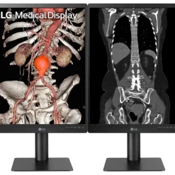 Moniteur d'affichage médical de diagnostic 3MP - 21