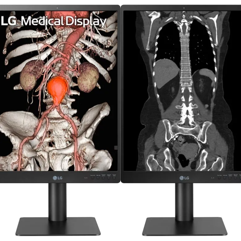 Moniteur d'affichage médical de diagnostic 3MP - 21" LG Electronics 21HQ513D