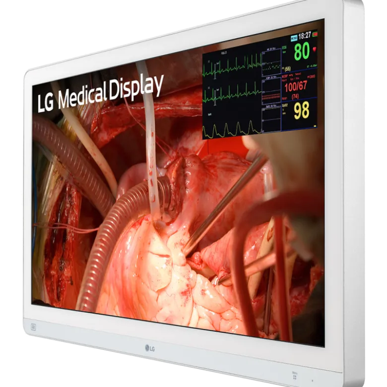 Moniteur d'affichage médical de chirurgie 4K - 27" - 3G - LG Electronics 27HQ710S