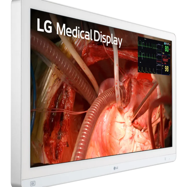 Moniteur d'affichage médical de chirurgie 4K - 27" - 3G - LG Electronics 27HQ710S