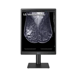 Moniteur d'affichage médical pour mammographie 5MP - 21" LG Electronics 21HQ613D