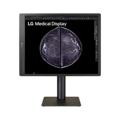 Moniteur d'affichage médical pour mammographie 5MP - 21