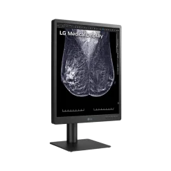 Moniteur d'affichage médical pour mammographie 5MP - 21