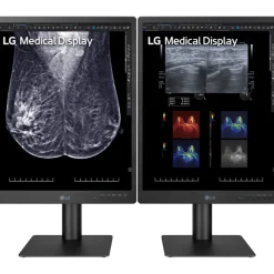 Moniteur d'affichage médical pour mammographie 5MP - 21