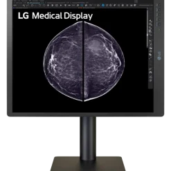Moniteur d'affichage médical pour mammographie 5MP - 21