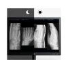 Moniteur d'affichage médical pour mammographie 12MP - 31" LG Electronics 31HN713D