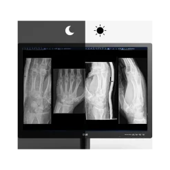 Moniteur d'affichage médical pour mammographie 12MP - 31" LG Electronics 31HN713D