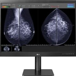 Moniteur d'affichage médical pour mammographie 12MP - 31