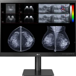 Moniteur d'affichage médical pour mammographie 12MP - 31