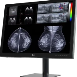 Moniteur d'affichage médical pour mammographie 12MP - 31