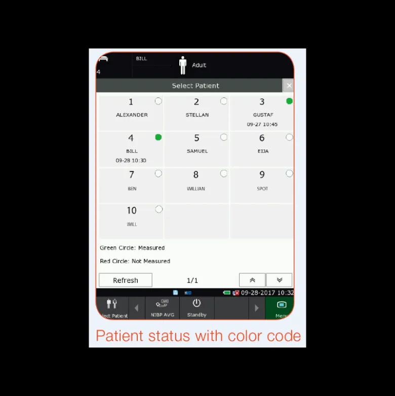 Moniteur patient multiparamétrique Edan IM3 avec écran tactile (PNI, SpO2, avec ou sans Temp.)