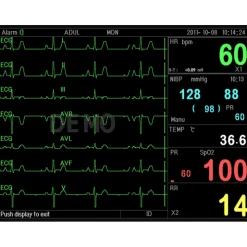 Moniteur patient multiparamétrique GIMA PC-3000 (PNI, SpO2, Temp., Resp.,ECG)