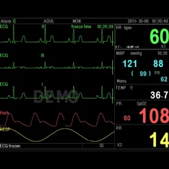 Moniteur patient multiparamétrique GIMA PC-3000 (PNI, SpO2, Temp., Resp.,ECG)