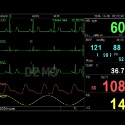 Moniteur patient multiparamétrique GIMA PC-3000 (PNI, SpO2, Temp., Resp.,ECG)