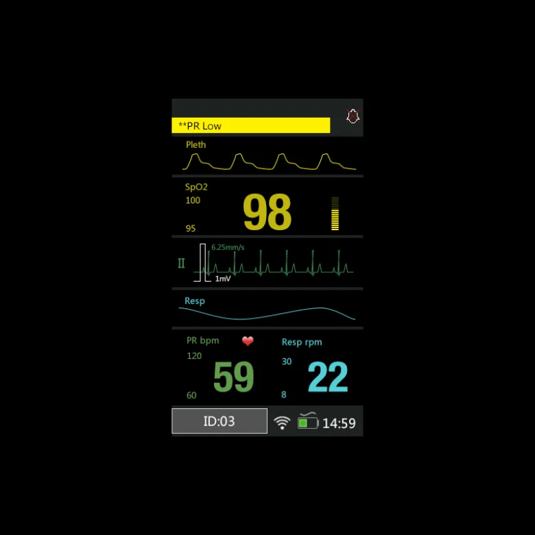 Moniteur patient multiparamétrique BLT M850 (SpO2, ECG)