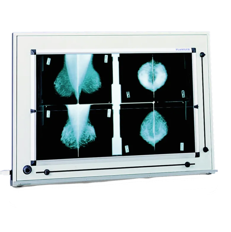 Négatoscope de mammographie à LED DXHM avec variateur (1,2,3,4,5 plages)