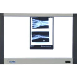 Négatoscope extra-plat avec interrupteur Holtex (1 ou 2 plages)