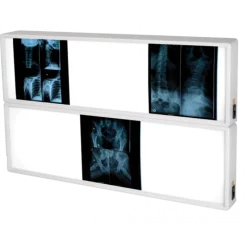 Négatoscope Gima avec interrupteur (1, 1.5, 2, 3 ou 4 plages)