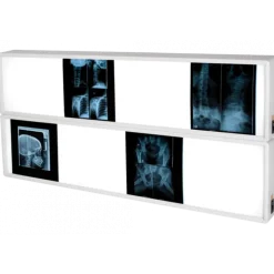 Négatoscope Gima avec interrupteur (1, 1.5, 2, 3 ou 4 plages)