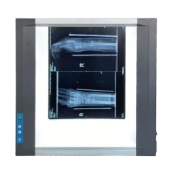 Négatoscopes LED extra-plat Devatoscope avec variateur (1 ou 2 plages)