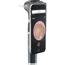 Otoscope Welch Allyn Macroview 2 Plus iExaminer LED