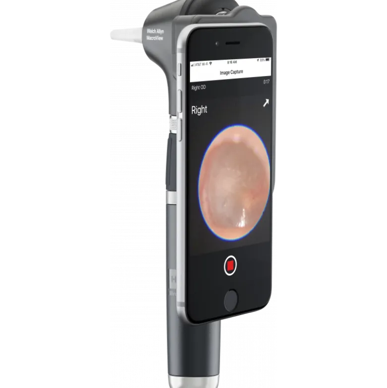 Otoscope Welch Allyn Macroview 2 Plus iExaminer LED