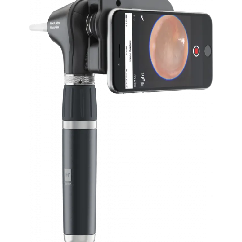 Otoscope Welch Allyn Macroview 2 Plus iExaminer LED