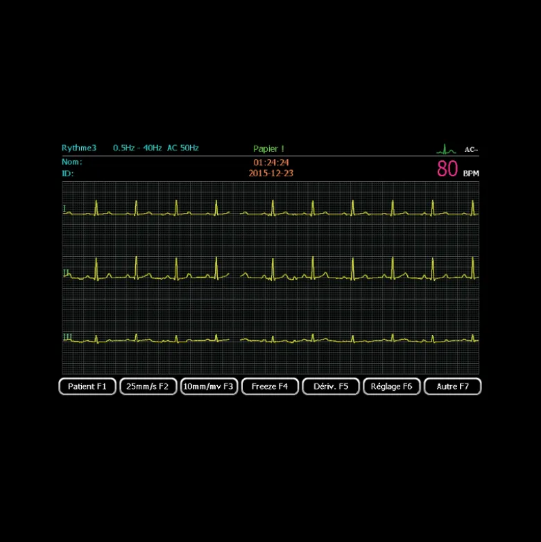 Pack promo ECG Spengler Cardiomate 3 (3 pistes) avec interprétation