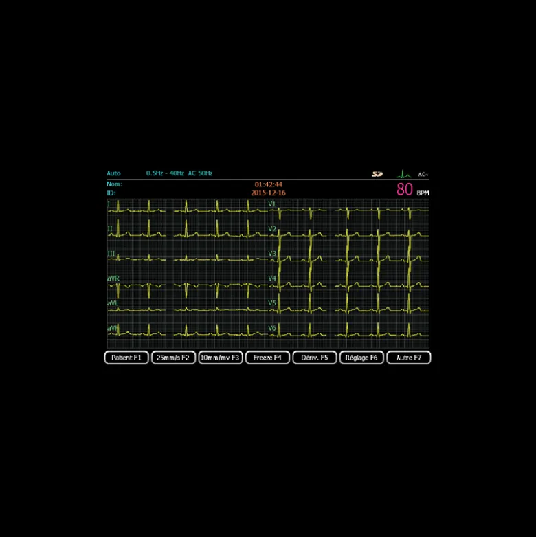 Pack promo ECG Spengler Cardiomate 3 (3 pistes) avec interprétation