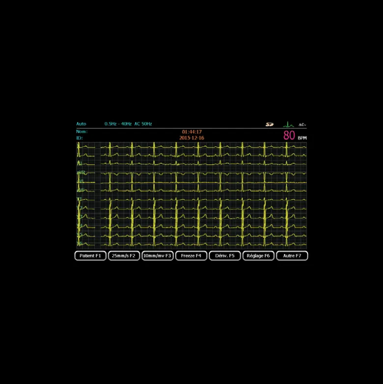Pack promo ECG Spengler Cardiomate 3 (3 pistes) avec interprétation