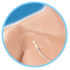Pansement adhésif Securifix Plus pour cathéter (boite de 50)