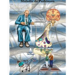 Planche anatomique 3B Scientific - La maladie de Parkinson VR2629