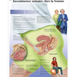 Planche anatomique 3B Scientific - L'incontinence urinaire chez la femme VR2542